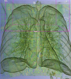 Medical imaging example